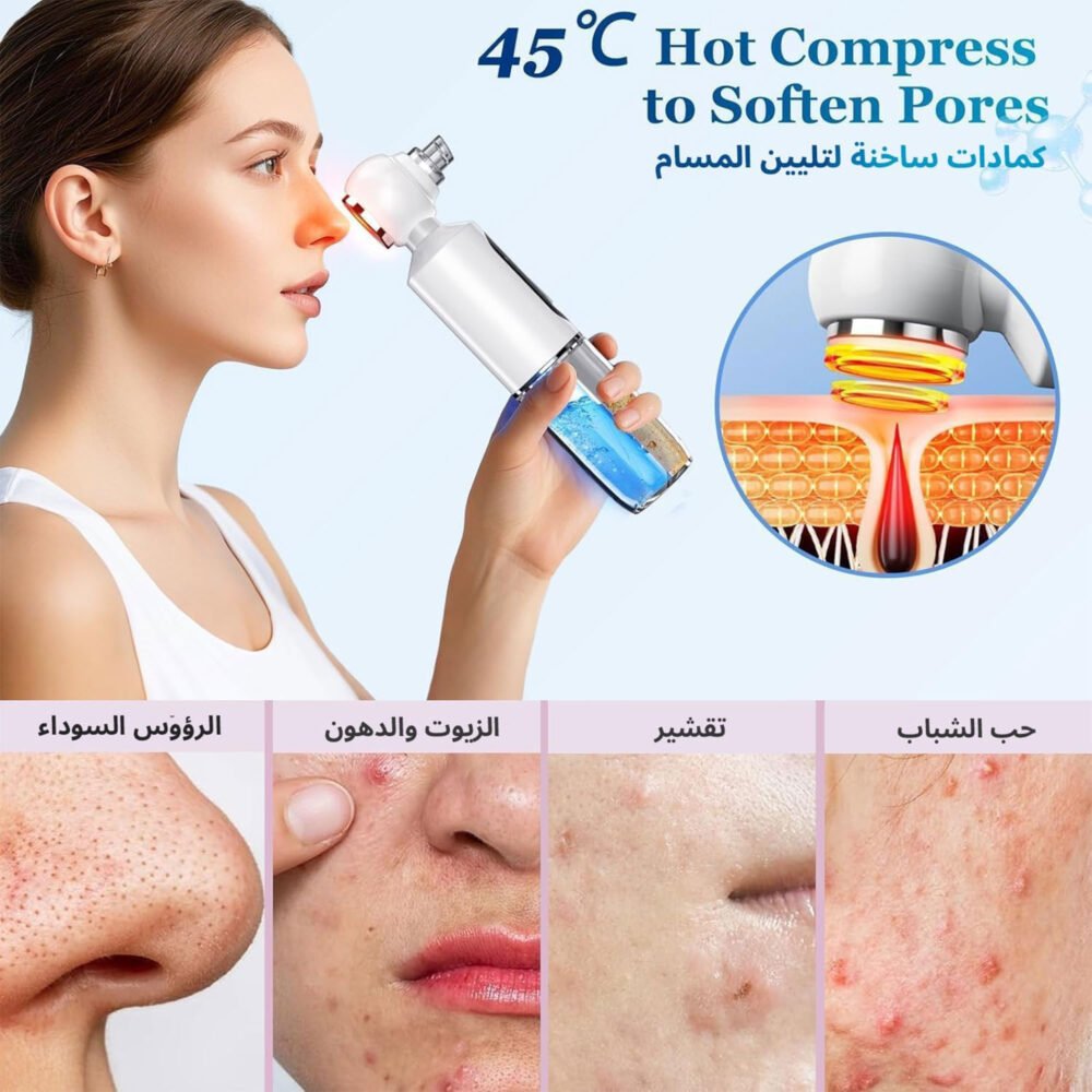 جهاز إزالة الرؤوس السوداء وشفط المسام 4 2c7fcbba b629 4040 b01f 3e0165af3af6