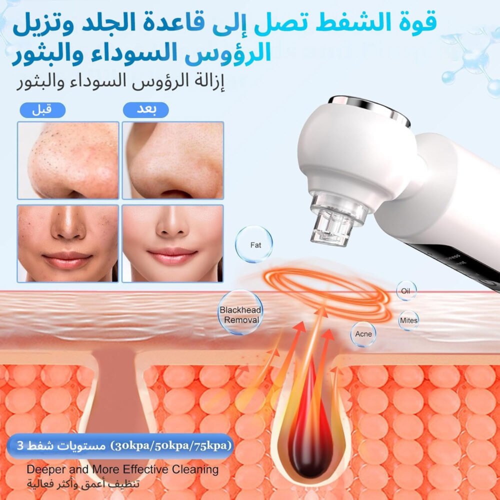 جهاز إزالة الرؤوس السوداء وشفط المسام 5 4dabfd75 5189 487d b55b 631e54acb956